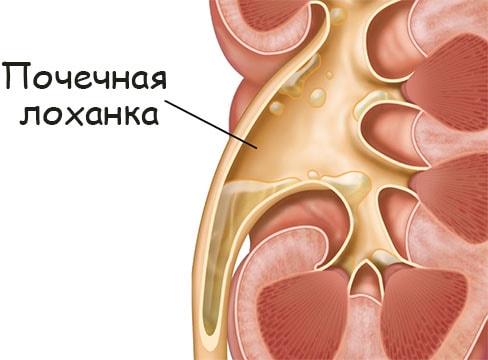 Что такое кракен площадка